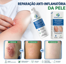 Kit 2 Unidades DermaCalm™ Spray Botânico Reparador com Magnésio PCA – Alívio Rápido da Coceira, Vermelhidão e Descamação da Pele, Psoríase e Eczema | Alívio Rápido, Sem Corticoides +BRINDE Kit Aplicador DermaCalm™ + Necessaire Dermatológica