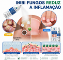 Kit 2 Unidades DermaCalm™ Spray Botânico Reparador com Magnésio PCA – Alívio Rápido da Coceira, Vermelhidão e Descamação da Pele, Psoríase e Eczema | Alívio Rápido, Sem Corticoides +BRINDE Kit Aplicador DermaCalm™ + Necessaire Dermatológica
