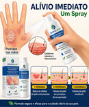 Kit 2 Unidades DermaCalm™ Spray Botânico Reparador com Magnésio PCA – Alívio Rápido da Coceira, Vermelhidão e Descamação da Pele, Psoríase e Eczema | Alívio Rápido, Sem Corticoides +BRINDE Kit Aplicador DermaCalm™ + Necessaire Dermatológica