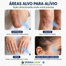 Kit 2 Unidades DermaCalm™ Spray Botânico Reparador com Magnésio PCA – Alívio Rápido da Coceira, Vermelhidão e Descamação da Pele, Psoríase e Eczema | Alívio Rápido, Sem Corticoides +BRINDE Kit Aplicador DermaCalm™ + Necessaire Dermatológica